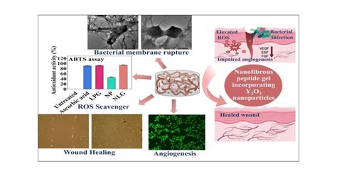 Yttrium-oxide: Biocompatibiliteit en mechanische eigenschappen voor een revolutionaire toekomst in de medische technologie!